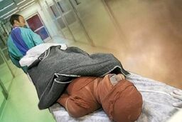 آمارن نگران‌کننده از میزان سوختگی‌ها: ایرانی‌ها ۸ برابر دنیا دچار سوختگی می‌شوند